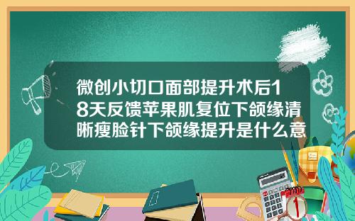 微创小切口面部提升术后18天反馈苹果肌复位下颌缘清晰瘦脸针下颌缘提升是什么意思