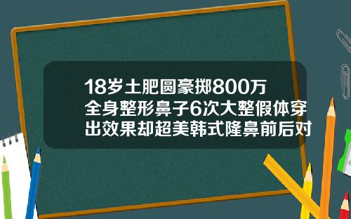 18岁土肥圆豪掷800万全身整形鼻子6次大整假体穿出效果却超美韩式隆鼻前后对比图